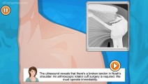 Shoulder Surgery: Shoulder Surgery